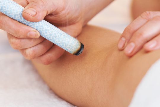 Moxa in der Traditionellen Chinesischen Medizin